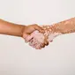 Ilustrasi vitiligo. (dok. Pexels.com/Photo by Armin Rimoldi)