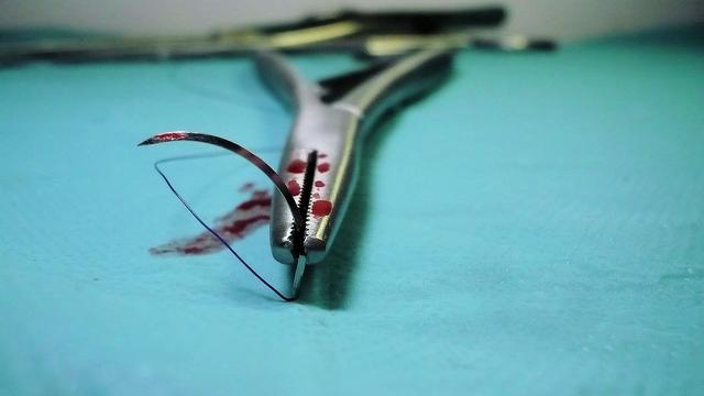 Ilustrasi alat operasi (pixabay)