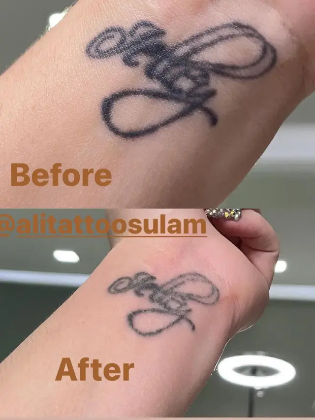 6 Momen Celine Evangelista Hapus Semua Tato, Termasuk Tato Tanggal Pernikahan