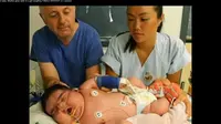 Baby Jasleen lahir dengan proses alami meski bobot tubuhnya terbilang besar.