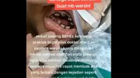 Warsini, Pekerja Migran Indonesia (PMI) yang bekerja di Taiwan, mengalami infeksi otak dan kebutaan pada sebelah matanya, karena menggunakan kawat gigi (behel) abal-abal. (Dok. Tangkapan Layar X/@jujukyung)
