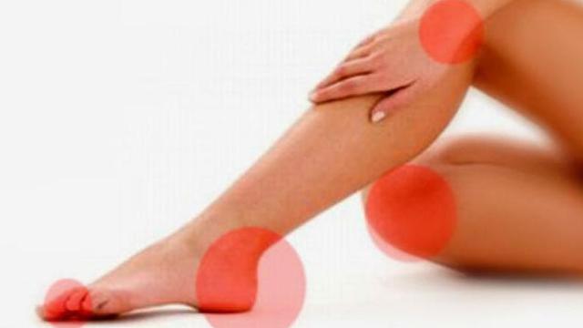 Ini Bedanya Asam Urat dan Neuropati