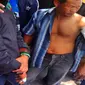 Seorang fans PSCS Cilacap tampak diperban tangannya usai penyerangan bus yang mereka tumpangi (Fathi Mahmud/Liputan6.com)