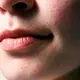 Jerawat yang sering muncul dapat membuat perawatan kulit terasa tidak pernah benar-benar efektif (Sumber: Pexels.com)