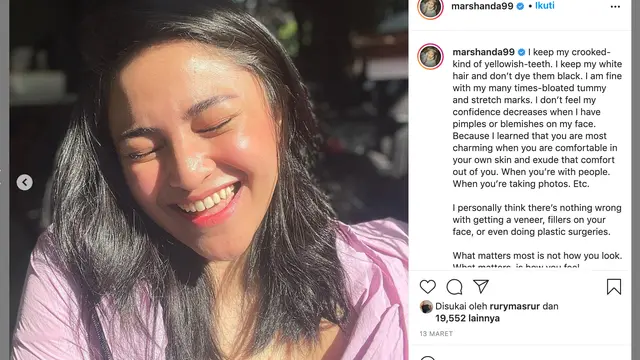 Unggahan Marshanda. (Foto: Instagram @marshanda99)