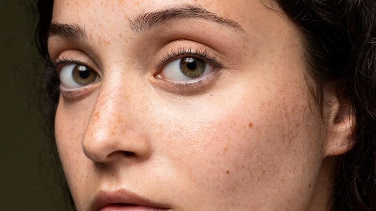Cara Mengatasi Flek Hitam di Wajah dengan AHA Alami, Tak Perlu Beli Serum