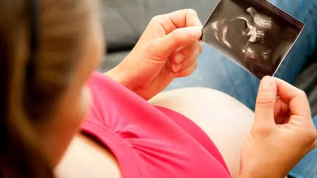 Foto: copyright shutterstock.com