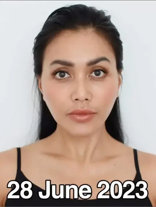 Bahkan sebelum menjalani operasi, Denada menangis saat telpon manajernya. “Besokannya mau prosedur aku nangis di hotel tapi aku cuma merem, aku cuma bilang bahwa aku tahu niatku apa, aku mantap gitu, nawaitu ku tuh apa berangkat ke sana niatku adalah ini ikhtiarku untuk cari nafkah," kata Denada. [Instagram/denadaindonesia]