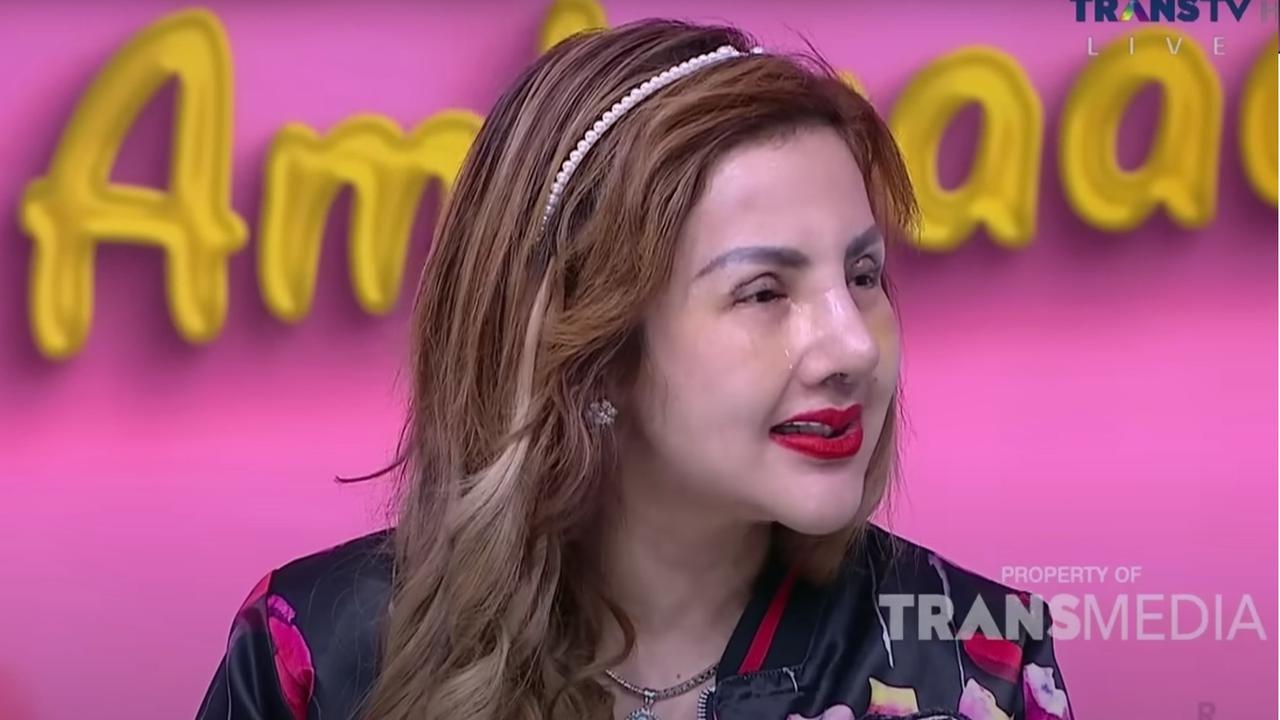 Demi Tampil Sempurna, Barbie Kumalasari Rogoh Ratusan Juta untuk Operasi Plastik ke-9 Kalinya
