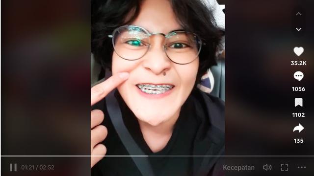 Mita The Virgin Geram, Langsung Klarifikasi Usai Dituding Pakai Narkoba Karena Mulutnya yang Bergerak Terus-Menerus: Gue Baru Pasang Behel. (TikTok @mitathevirgin)