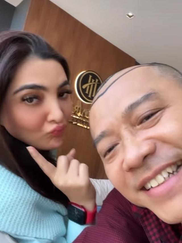 Dikira Raul Lemos, Ini 6 Potret Anang Hermansyah Usai Transplantasi Rambut di Turki