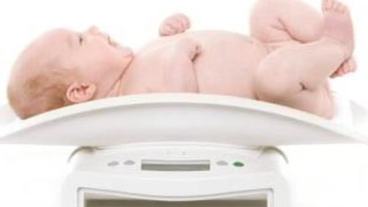 bayi obesitas
