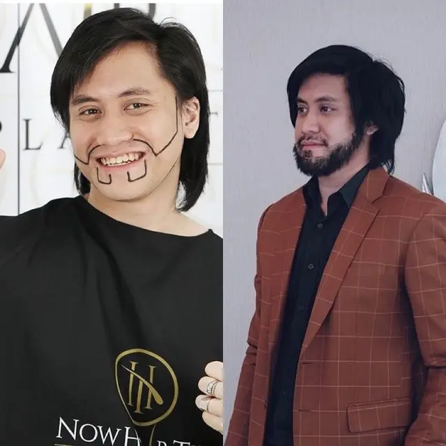 Potret Transformasi 6 Artis Usai Jalani Transplantasi Rambut, Kevin Aprilio-Atta Halilintar