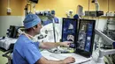 Dengan menggunakan HIFU Robot, dokter bedah dapat melihat gambaran isi rongga abdomen (perut) dengan gambar 2 dimensi di layar monitor. Rumah Sakit Edouard Herriot di Lyon, Prancis (10/4/2014) (AFP Photo/Jeff Pachoud).