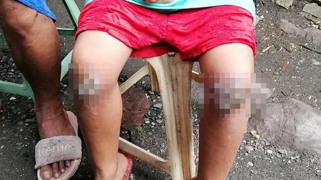 Lupa Bawa Pulang Tas Sekolah, Remaja Ini Dapat Hukuman Mengerikan