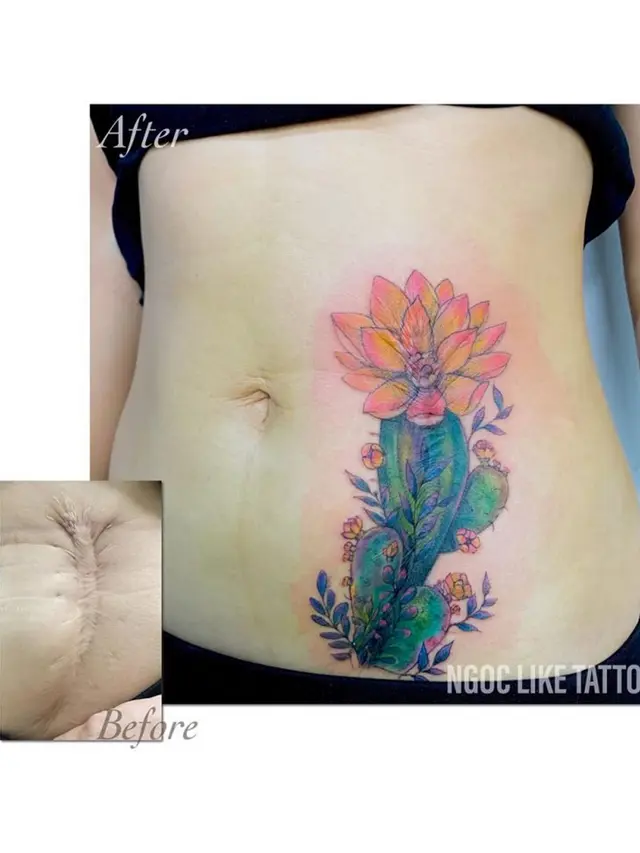 7 Potret Tato Keren Sulap Bekas Luka Jadi Seni Indah