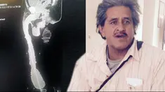 Sebuah penelitian menyebut penis Roberto itu asli dan bukan rekayasa.