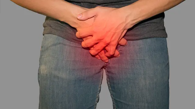 Penyakit Sifilis - KlikDokter.com (Icedmocha/Shutterstock)