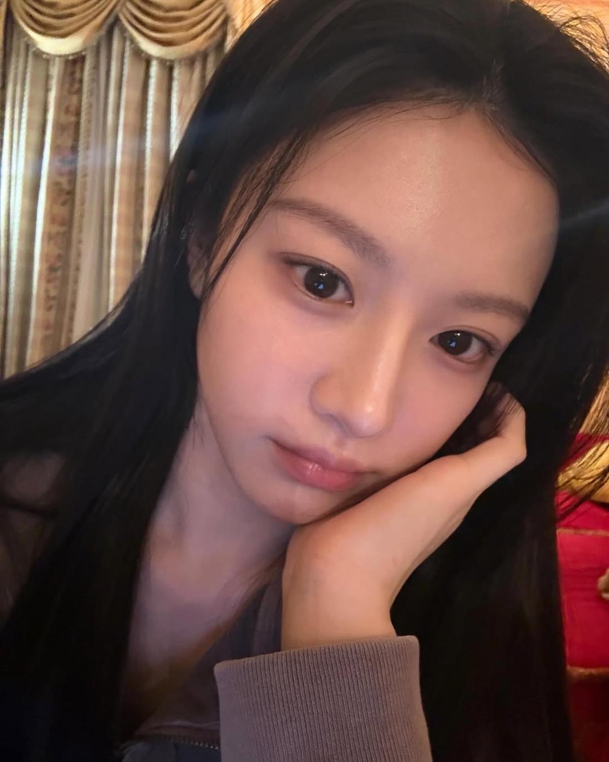 5 Potret Selfie Go Yoon Jung Pemeran Oh Yi Young di 'RESIDENT PLAYBOOK' yang Selalu Cantik