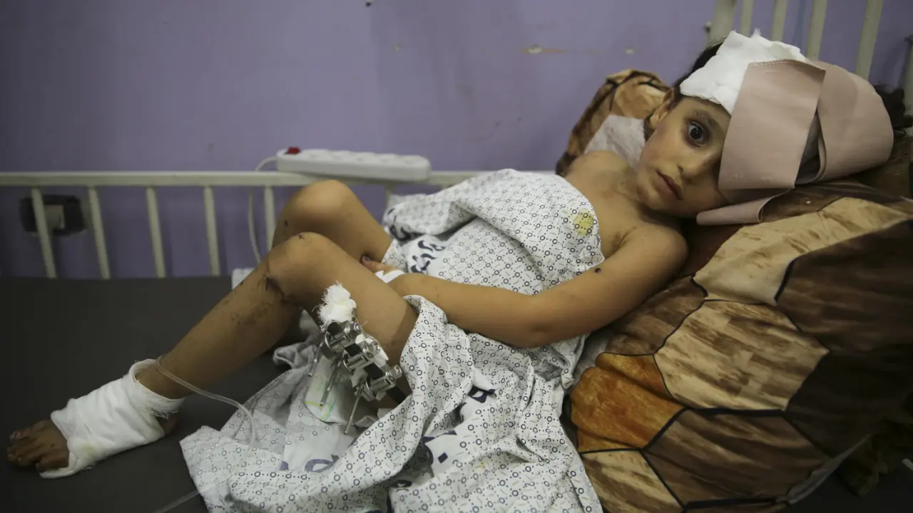 Kenzi Al Madhoun, seorang anak Palestina berusia empat tahun yang menjdi korban serangan Israel. Ia dirawat di RS Al Aqsa yang berlokasi di Jalur Gaza. (Ap Photo/Abdel Kareem Hana)
