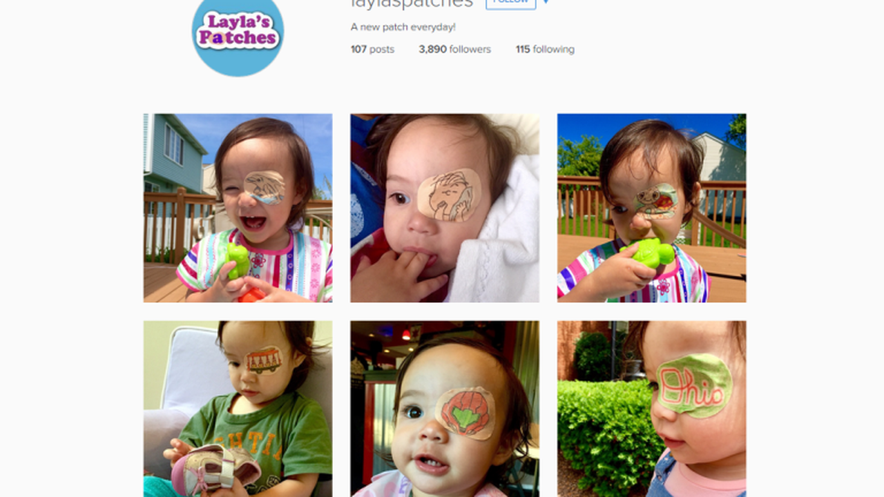 Ayah Ini Gambari Penutup Mata Anaknya Agar Tampak Indah