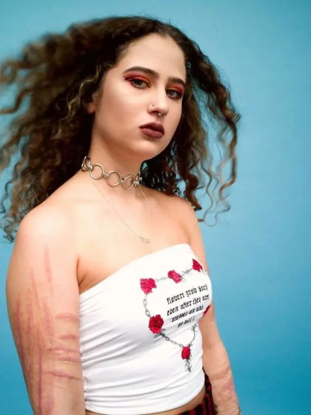 [Bintang] Cerita 5 Wanita dengan Bekas Luka di Tubuhnya, Bikin Terharu