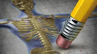 Rajin Minum Susu Tak Cukup Cegah Osteoporosis