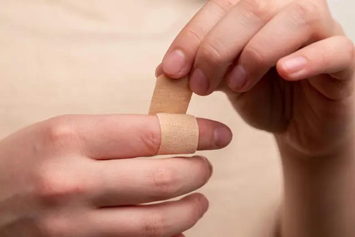 Kenali Gejala Kolesterol Tinggi dari Tanda Tak Biasa di Tangan