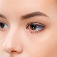 Pentingnya edukasi kesehatan mengenai strabismus (Foto: Pexels.com)