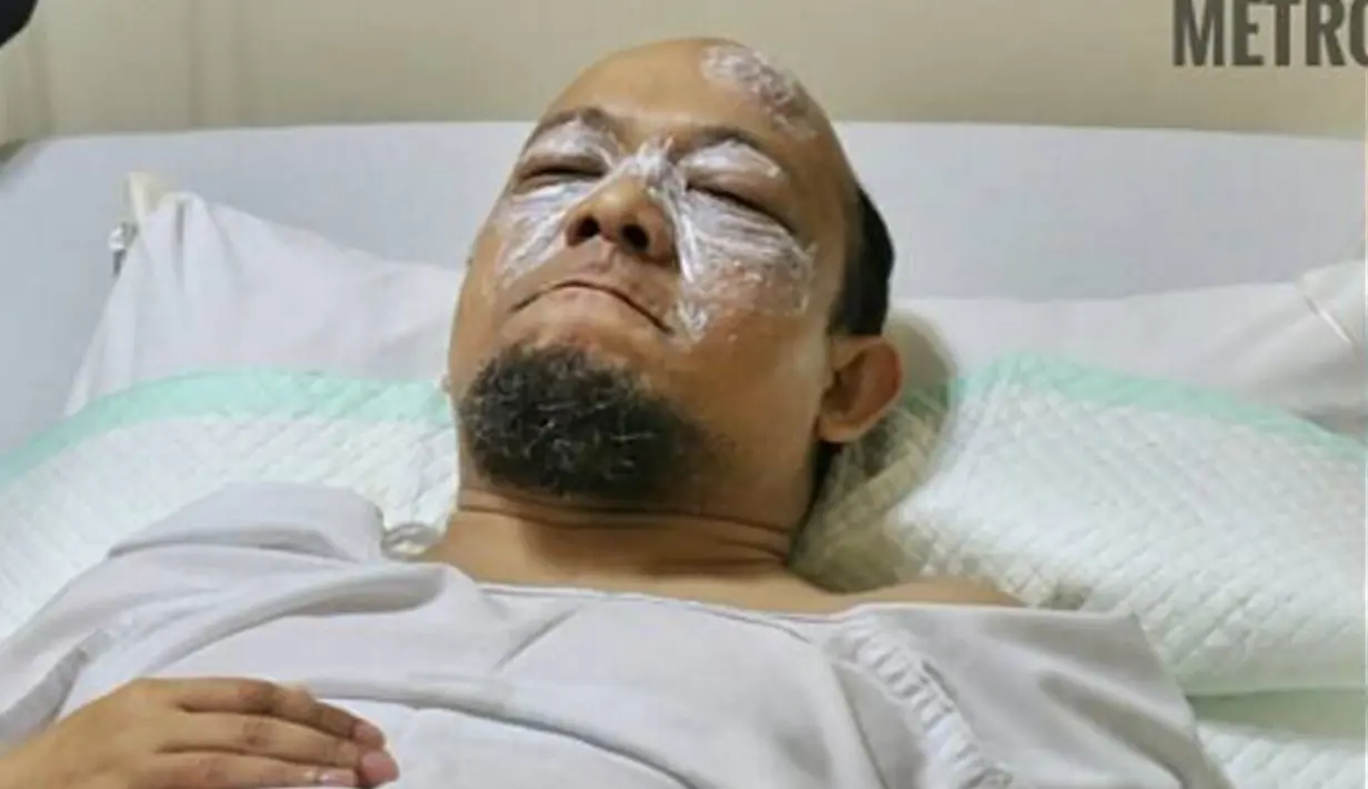 Novel Baswedan saat dirawat di Rumah Sakit Mitra Keluarga Kelapa Gading, Jakarta Utara, Selasa (11/4). Penyidik senior KPK tersebut menjadi korban penyiraman air keras saat pulang Salat Subuh. (Instagram/@spripimpoldametro)