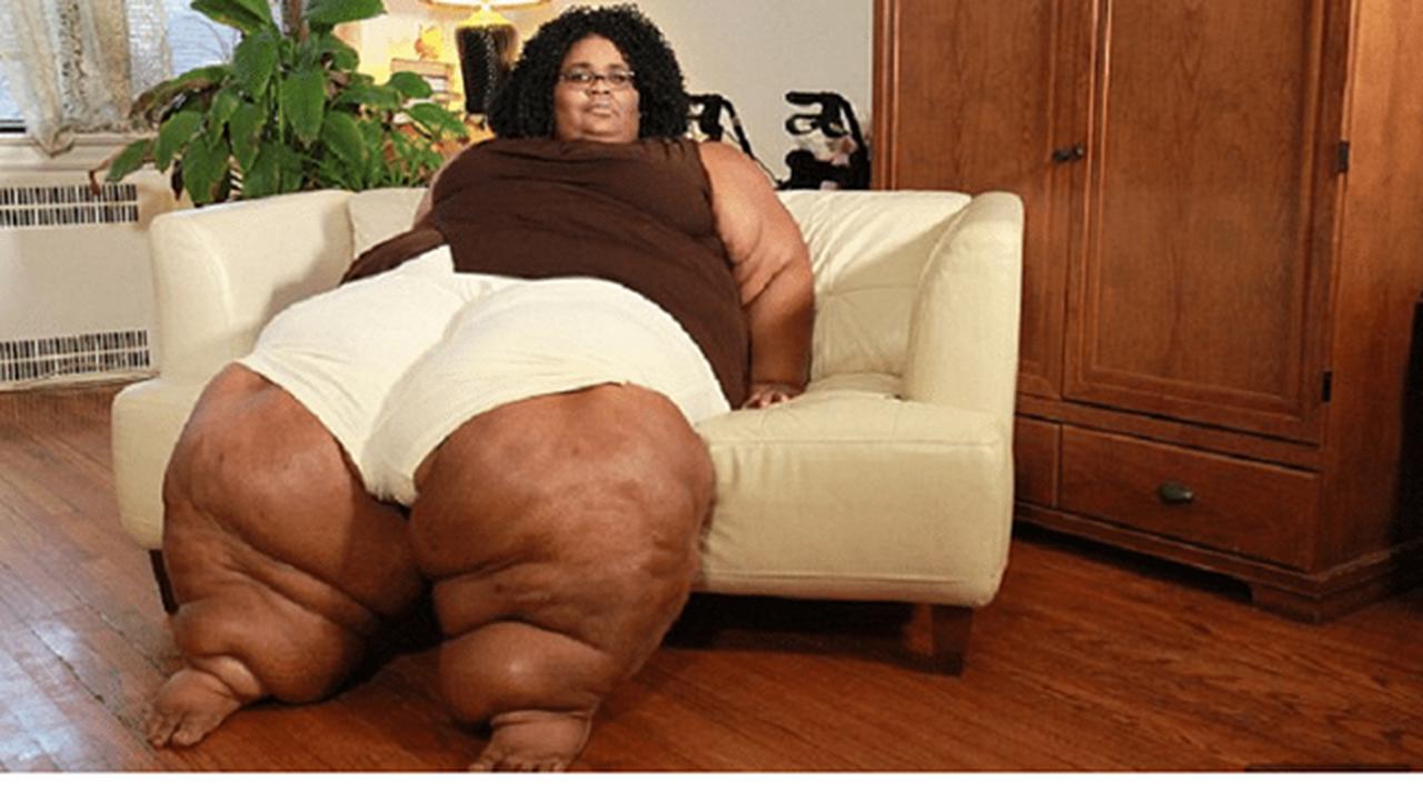 Malang, Kisah Gadis yang Kakinya Terus Membesar