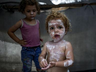 Seorang anak pengungsi Sham al-Hessi yang menderita penyakit kulit diolesi krim kulit saat berpose untuk difoto, di kamp tenda darurat di Deir al-Balah, Jalur Gaza tengah, Senin (29/7/2024). (AP Photo/Abdel Kareem Hana)