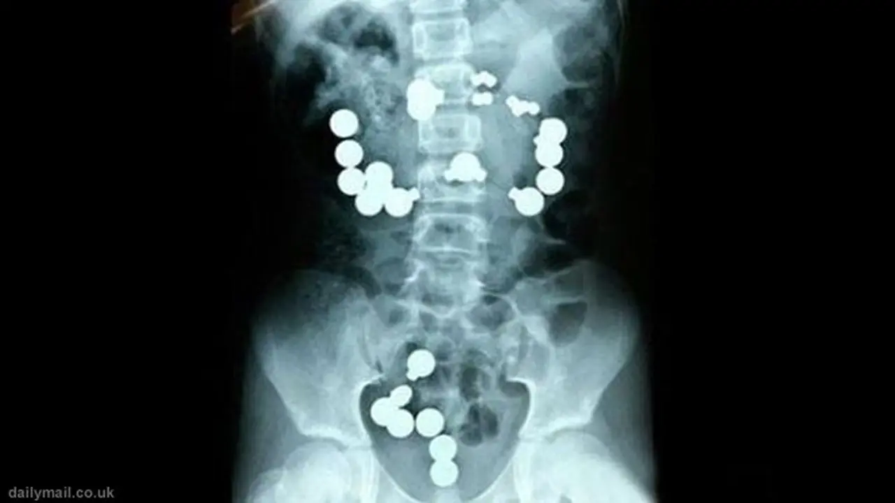 telan-magnet130214c.jpg