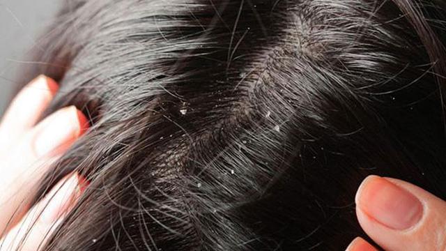 Ini Cara Jitu Atasi Rambut Berbagai Tipe