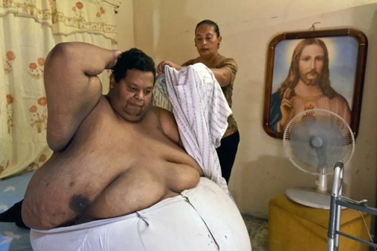 Berbobot 400 Kg, Pria Ini Butuh Pemadam Kebakaran Agar Bisa Hidup
