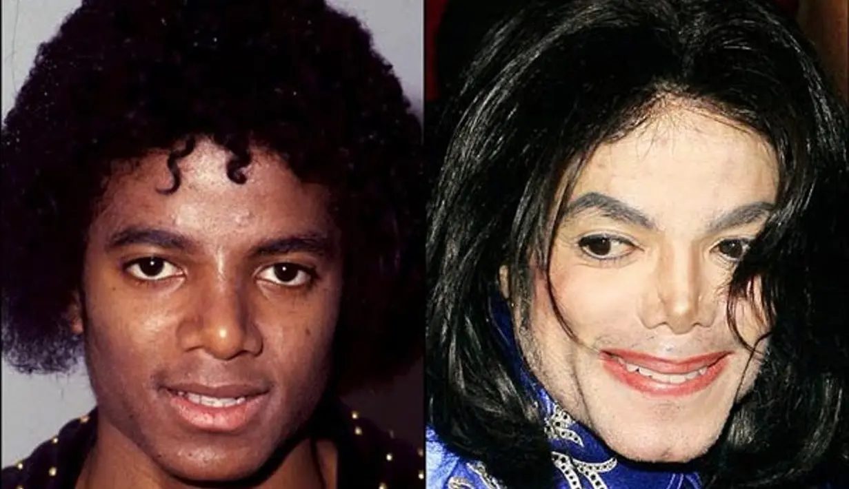 Kita semua pasti mencintai the King of Pop ini. Namun kamu pasti setuju bahwa keputusan Michael Jackson mengubah wajahnya terus-menerus bukanlah ide yang baik. (FoxNews)