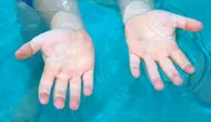 Jari Keriput Setelah Berenang Ternyata Bukan Karena Menyerap Air