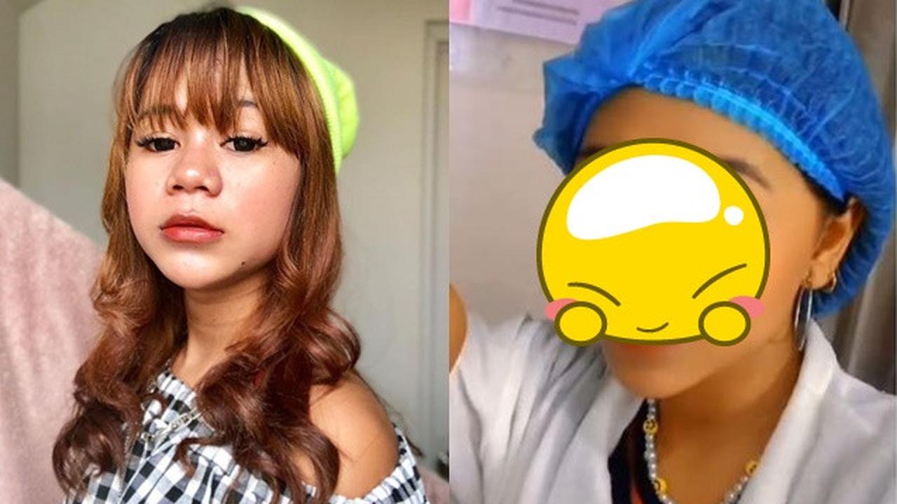 6 Potret Terbaru Cimoy Nuraini Usai Filler Hidung, Tampil Beda