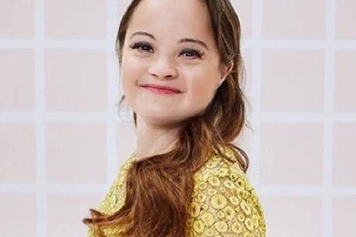 Katie Meade, Model Down Syndrome Pertama untuk Produk Kecantikan