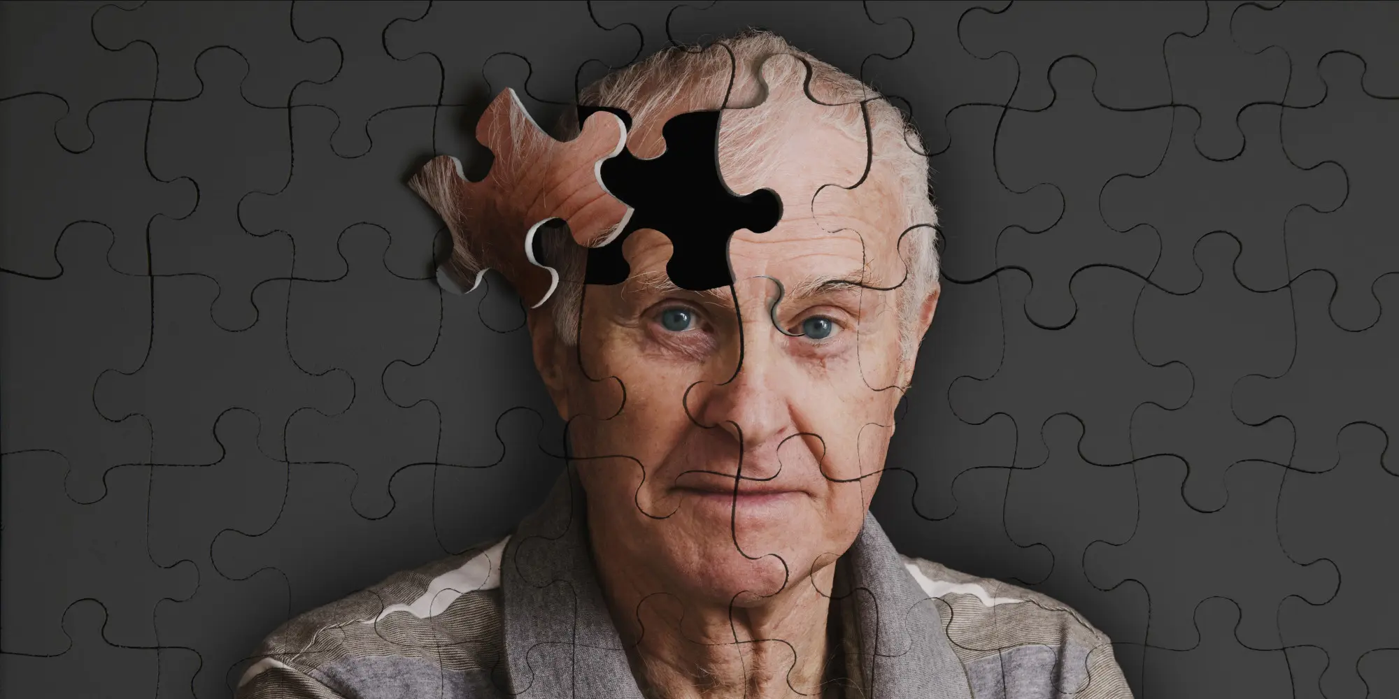Ilustrasi Alzheimer. (Sumber foto: liputan6.com).
