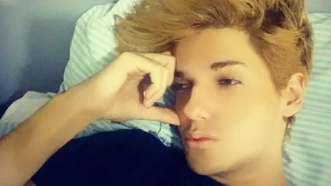 Kalah Melawan Leukimia, 'Boneka Ken' Meninggal Dunia