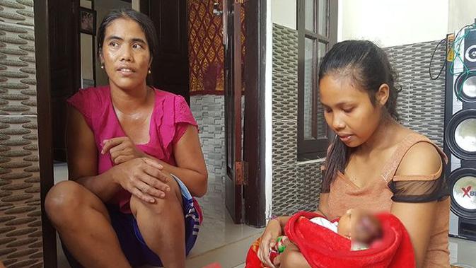 Bayi tanpa tempurung kepala yang lahir di Desa Tejakula, Bali, butuh bantuan. (Eka Prasetya/Radar Bali/Jawapos)
