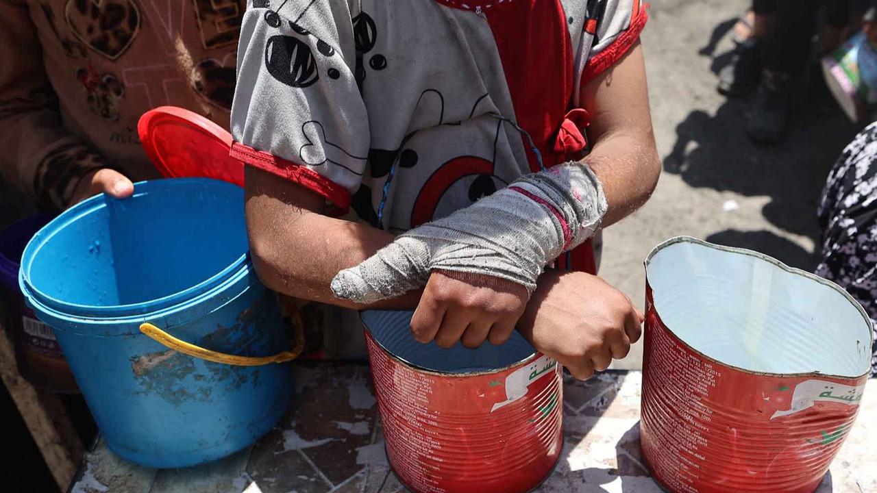FOTO: Kelaparan Kian Meluas dan Menimbulkan Korban Jiwa di Gaza
