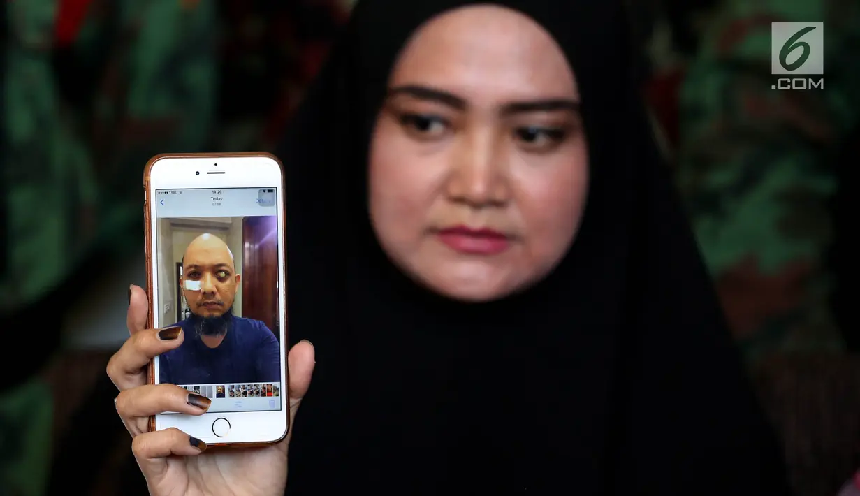 Rina Emilda menunjukan foto Novel Baswedan usai terkena air keras saat memberi keterangan pers di Jakarta, Senin (28/8). Rina Emilda juga meminta Presiden RI Joko Widodo menyelesaikan kasus Novel Baswedan. (Liputan6.com/Johan Tallo)