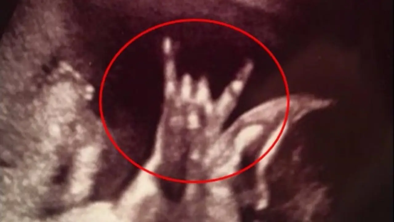 Fenomenal, Foto USG Janin Bergaya Rock Bikin Netizen Melongo