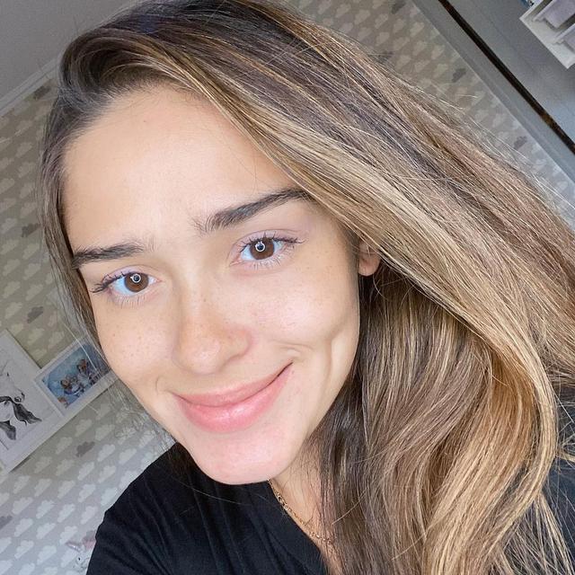 6 Artis Ini Tetap Memesona Saat Pamer Freckles, Banjir Pujian