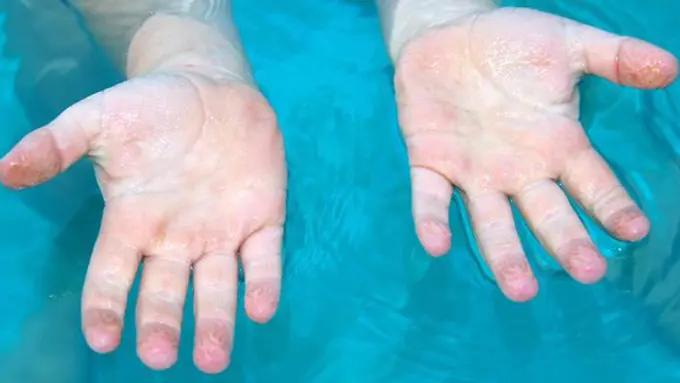 Copyright: istockphotos