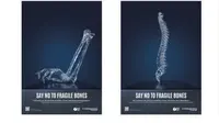 Hari Osteoporosis Sedunia 20 Oktober 2024, Katakan Tidak pada Tulang Rapuh. Foto: worldosteoporosisday.org.