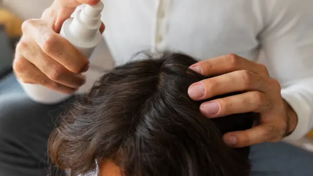 Ilustrasi obat kutu rambut (Foto: Freepik)