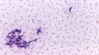Parasit Toxoplasma gondii. (Sumber CDC/Dr. L.L. Moore, Jr.)